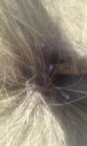 Fotografìa Atentado 1