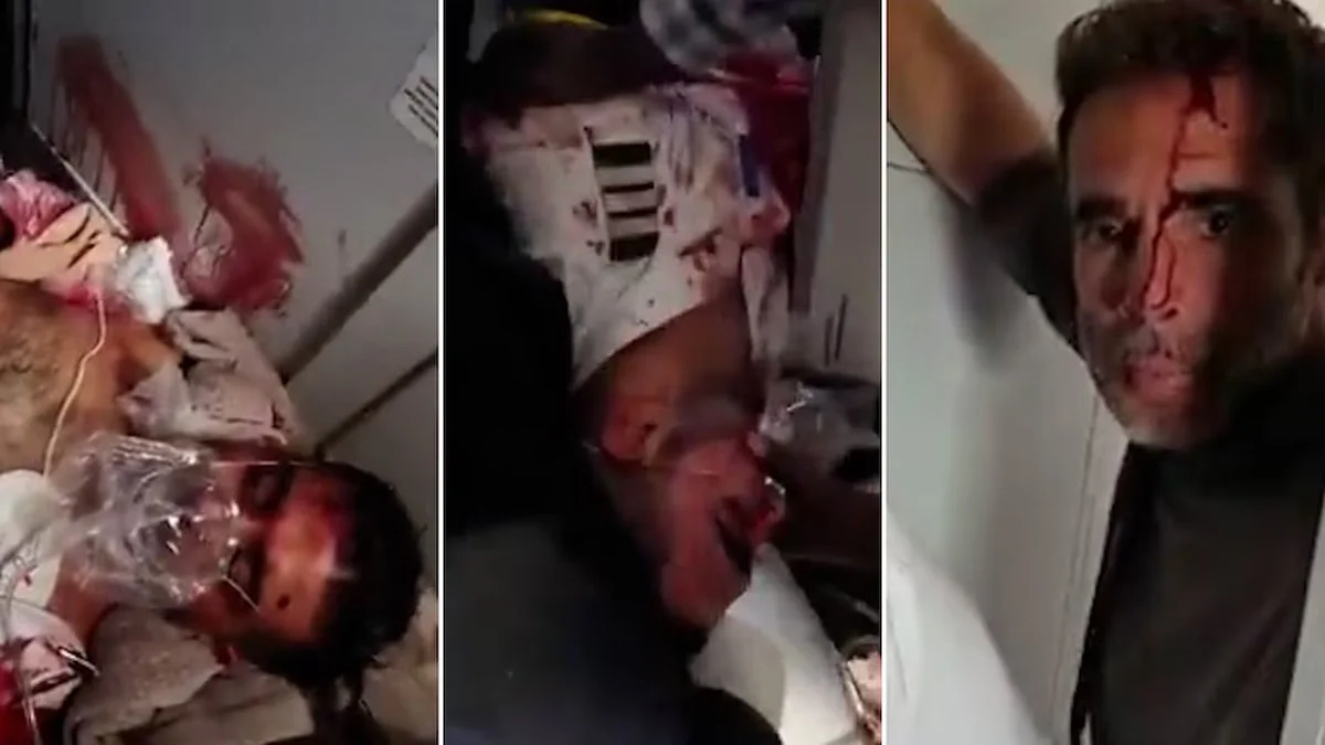 Uno de los pilotos fue gravemente herido en el avion