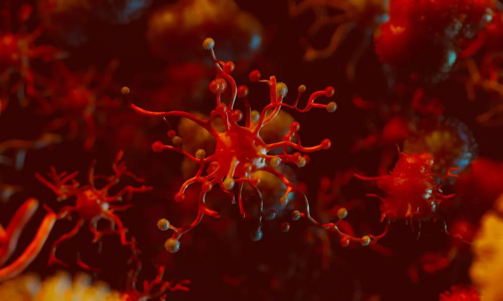 Mieloma múltiple. Foto Freepik