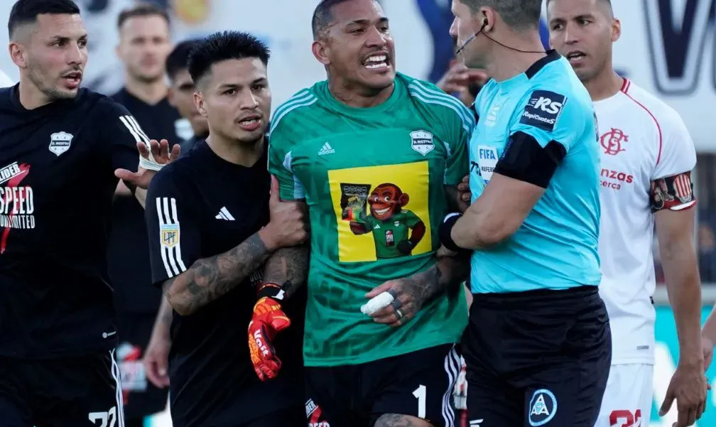 El arquero Ignacio Arce sufrió un fuerte golpe en la mano