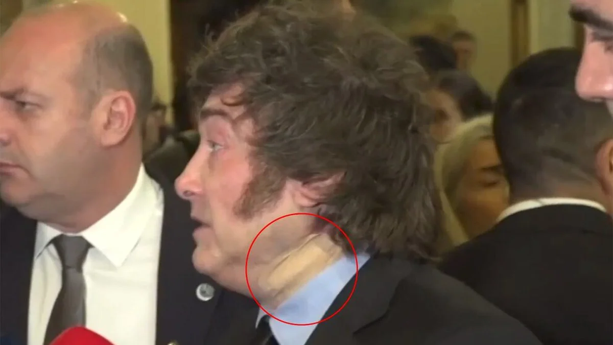 vendaje en el cuello
