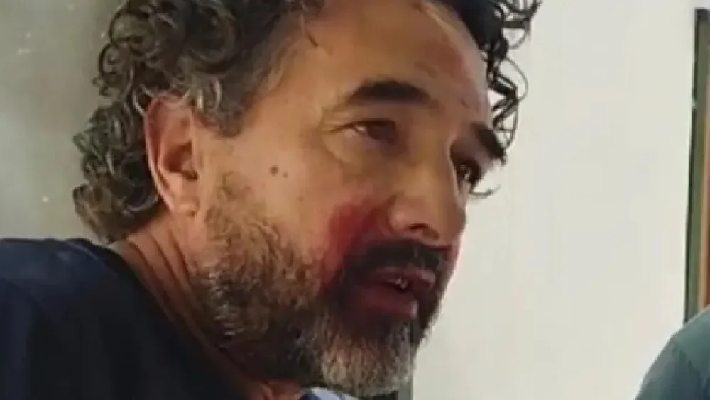 alejandro albaini golpeado_11zon_11zon