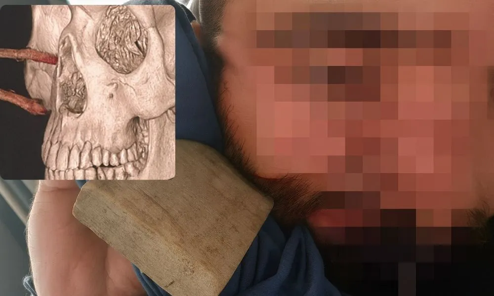 Accidente en Comodoro Rivadavia