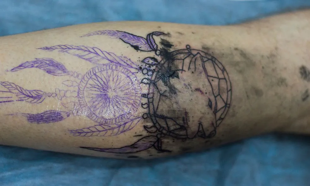 Tinta de tatuaje foto ilustrativa fuente Freepik