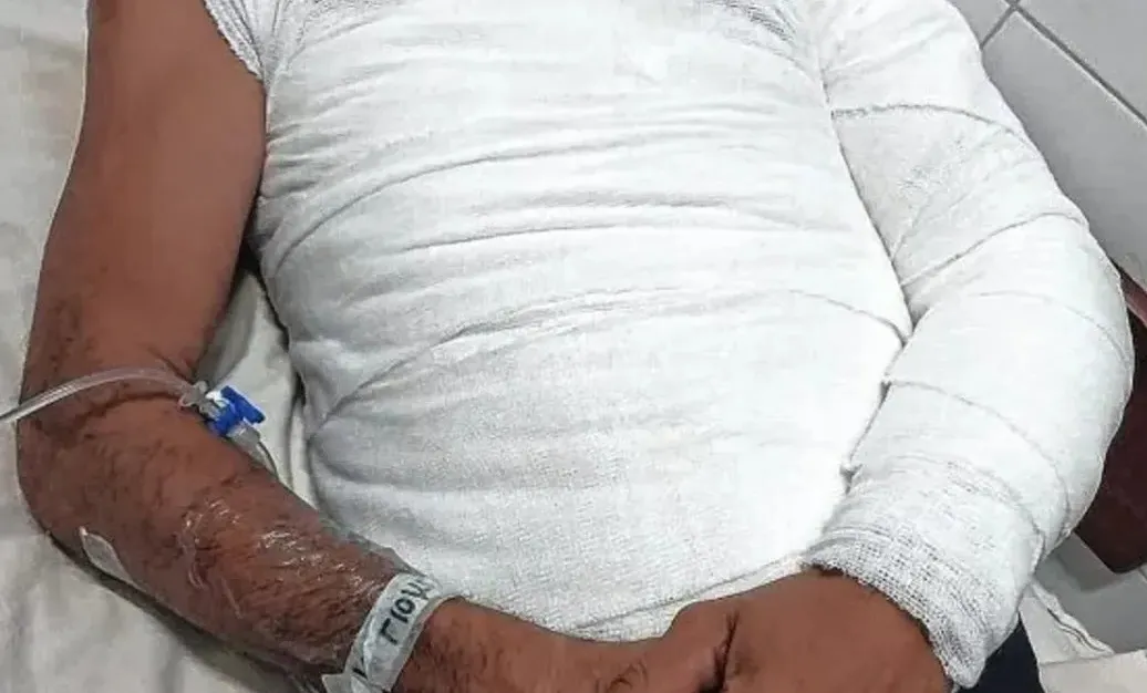 PELEABA CON SU HERMANO POR UNA MAYONESA Y LO PRENDIÓ FUEGO