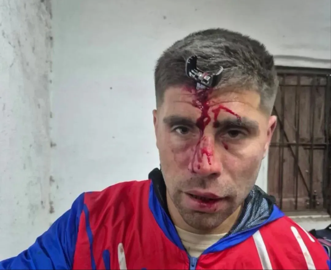 Jonathan Smith, jugador de Lamadrid, sufrió una agresión en un torneo femenino en Berazategui