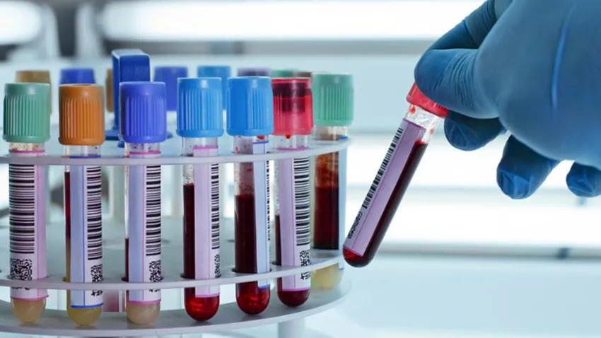 Bioquímicos