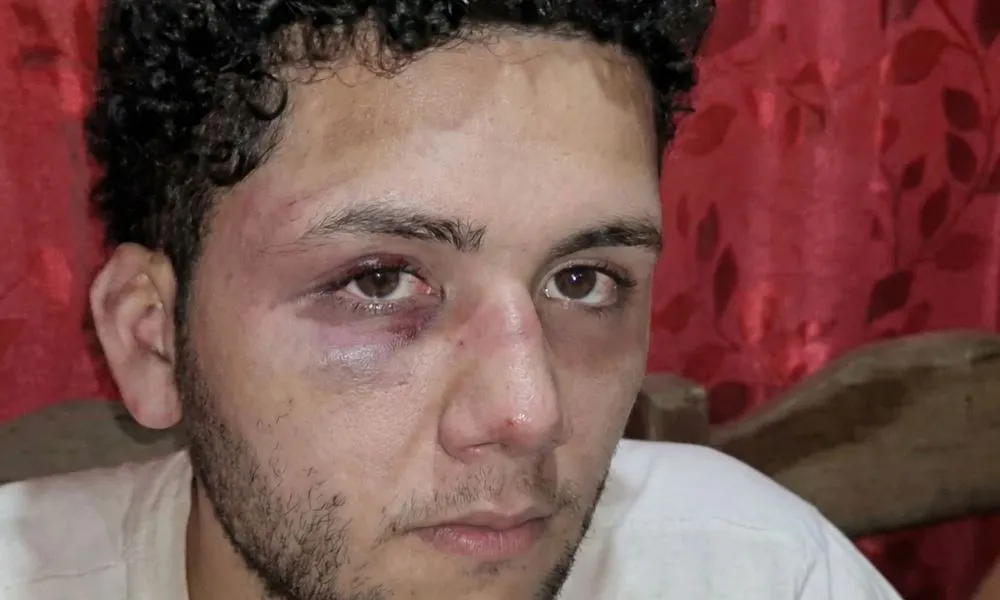 violencia laboral joven golpeado por un reclamo