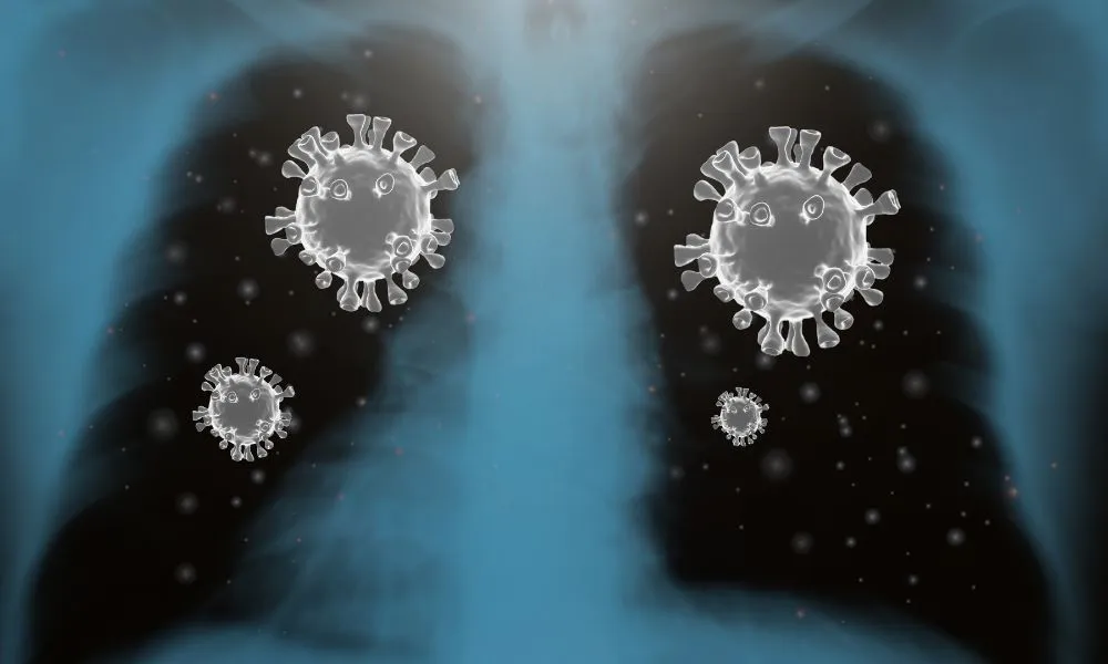 Virus sincicial respiratorio en adultos