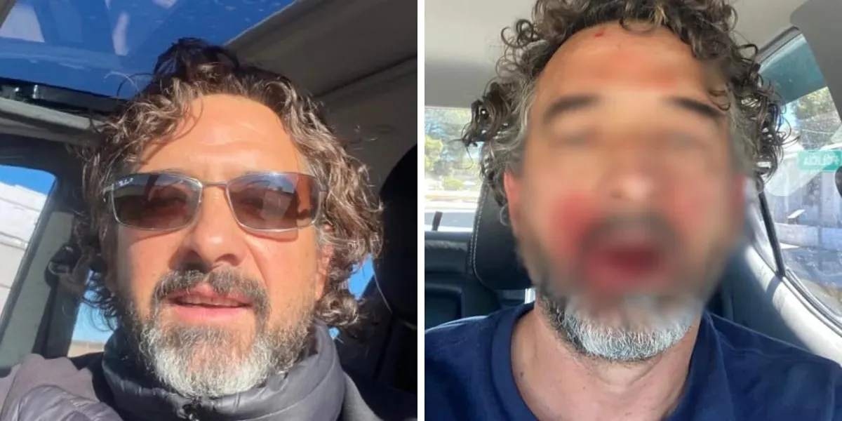 albaini agredido