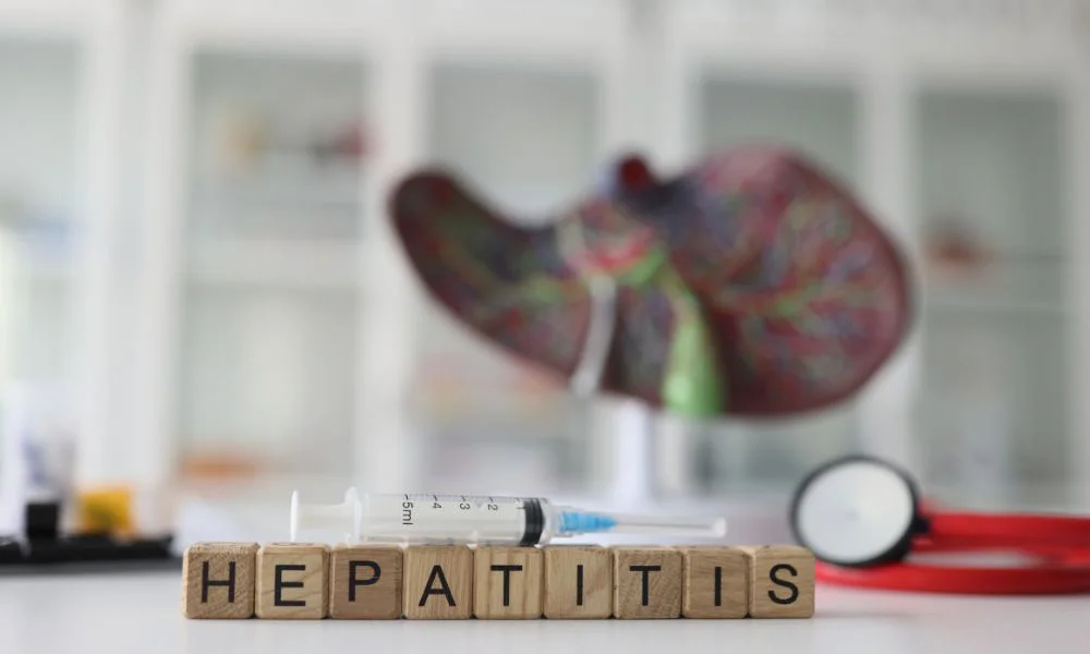 Hepatitis E. Foto Magnific
