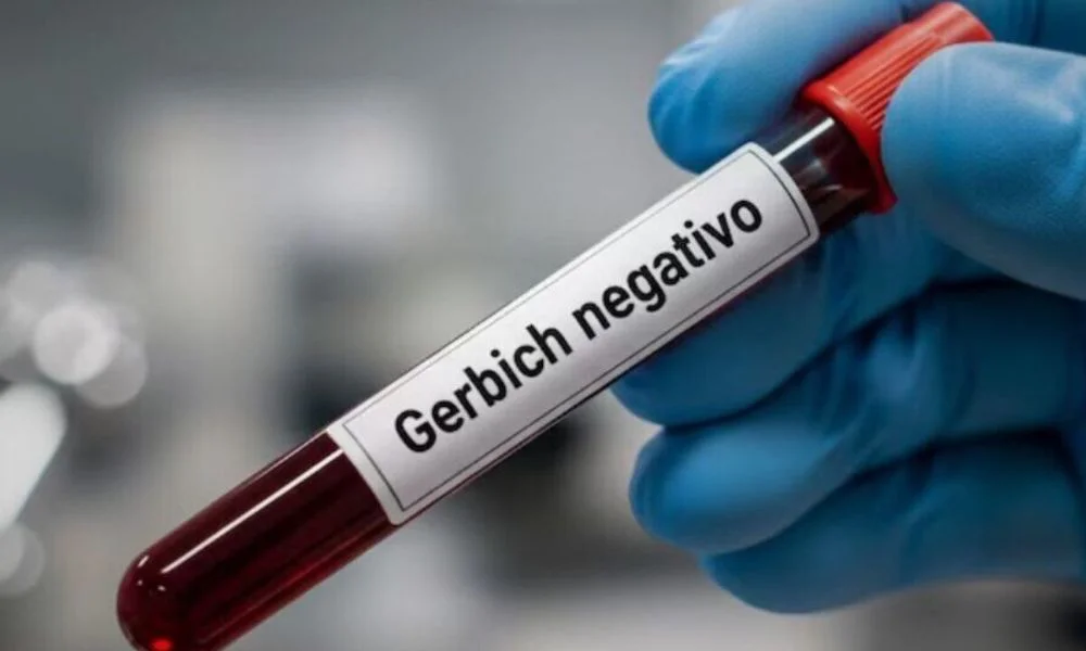 Sangre Gérbich Negativo