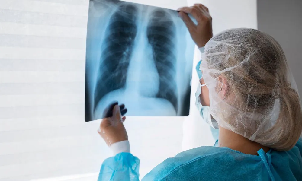 Médico analizando una radiografía de pulmones