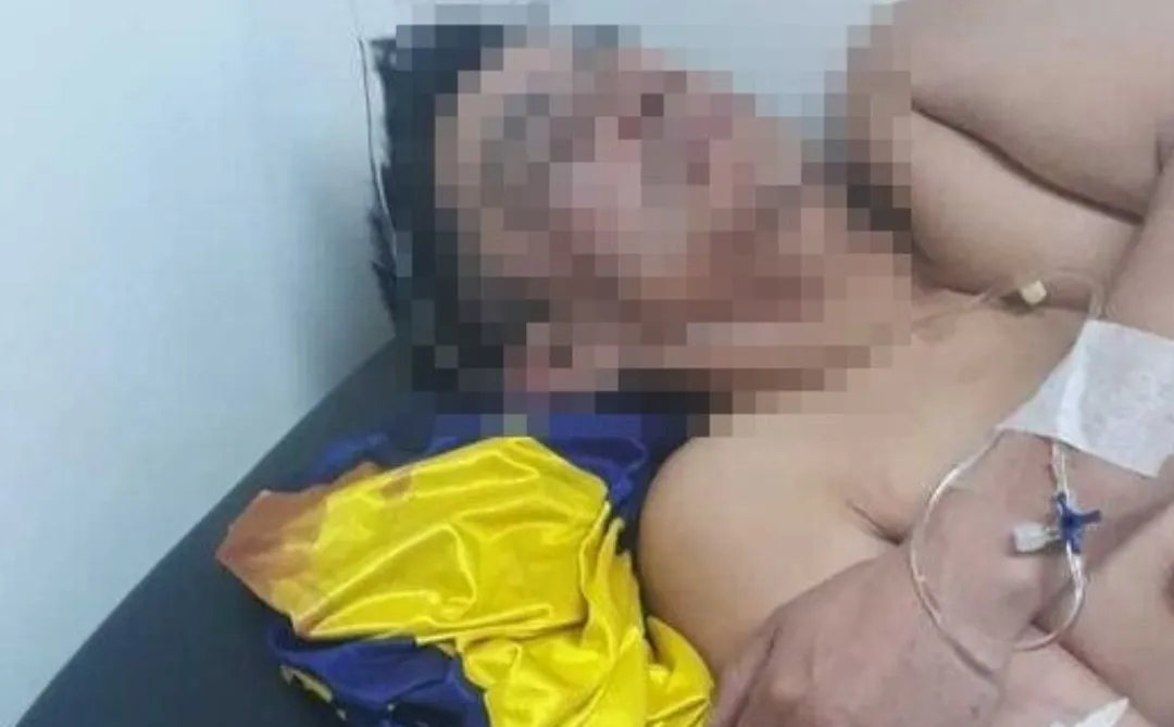 La vítima siendo atendida en el Hospital.
