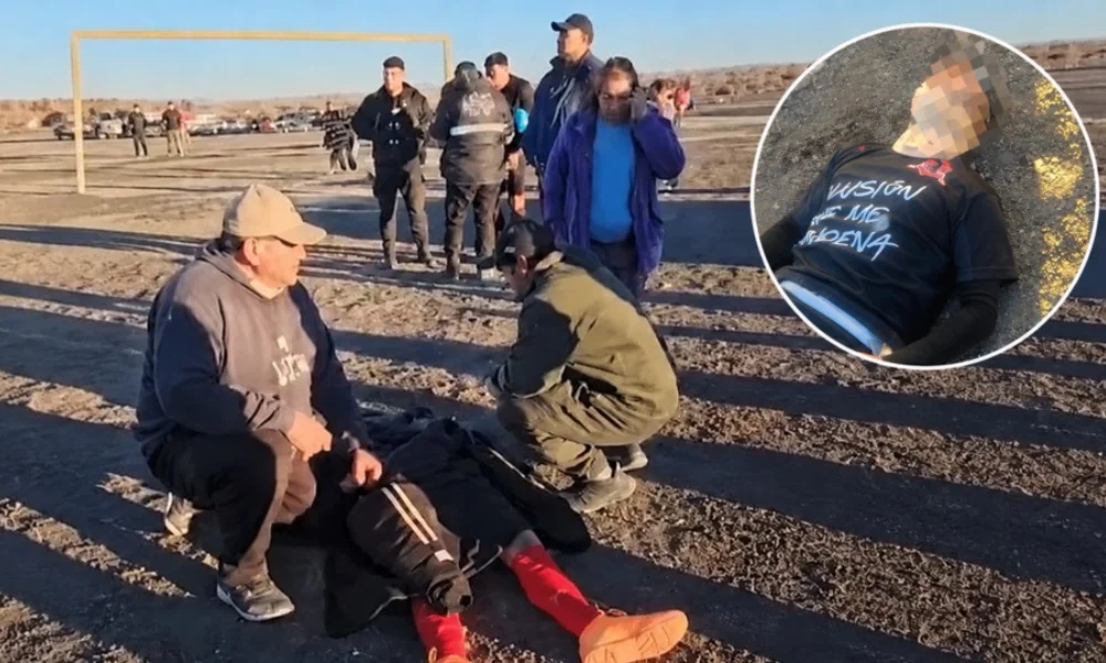jugador con fractura de mandíbula