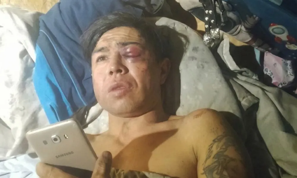 Vecino del bolsón que acusa a la policía