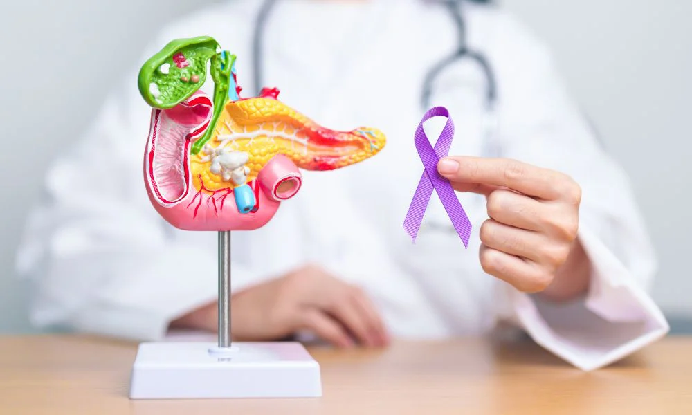 Cáncer de páncreas. Foto Magnific