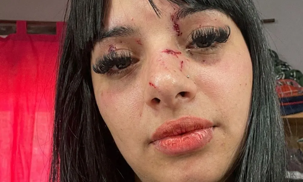 Anaí aseguró que ocho personas la golpearon