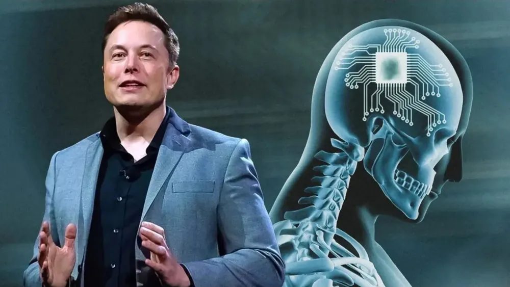 Elon-Musks-Neuralink