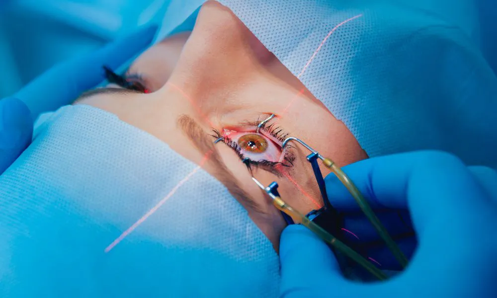 Cirugía ocular. Imagen ilustrativa