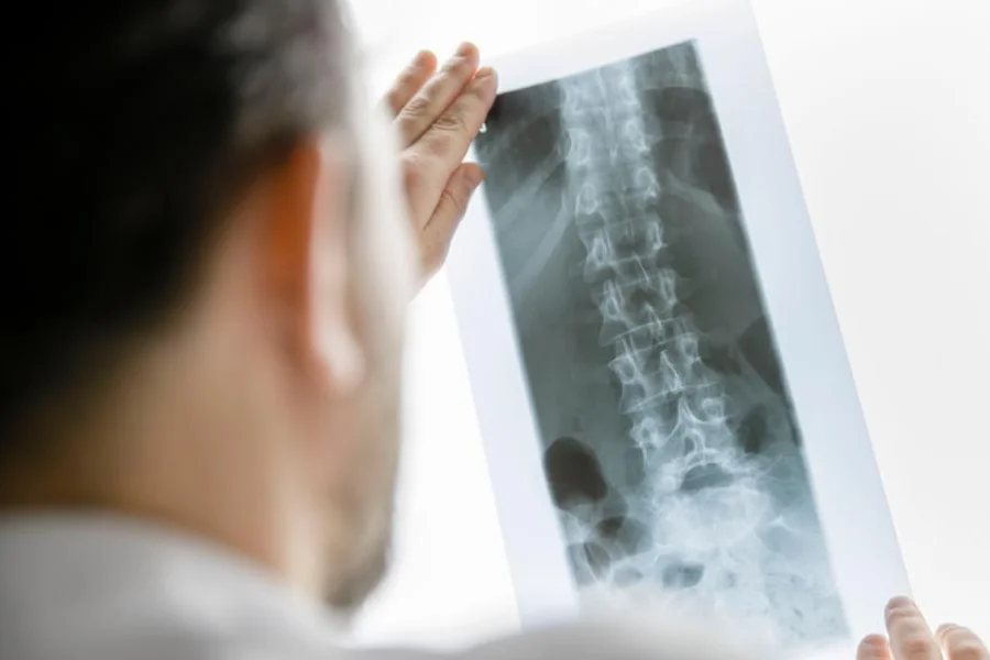 Radiografía auténtica