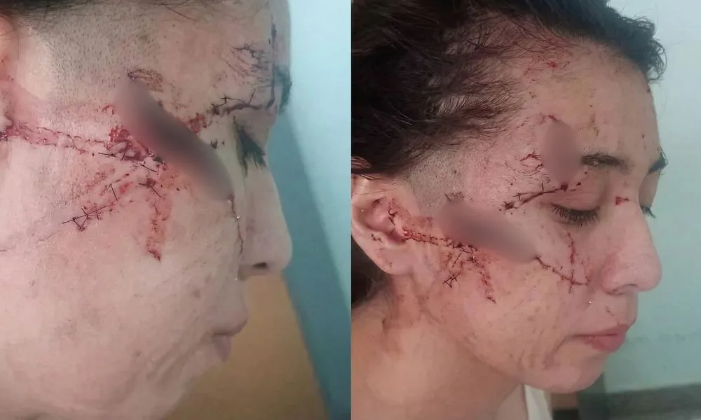 Adolescente atacada con un cuchillo