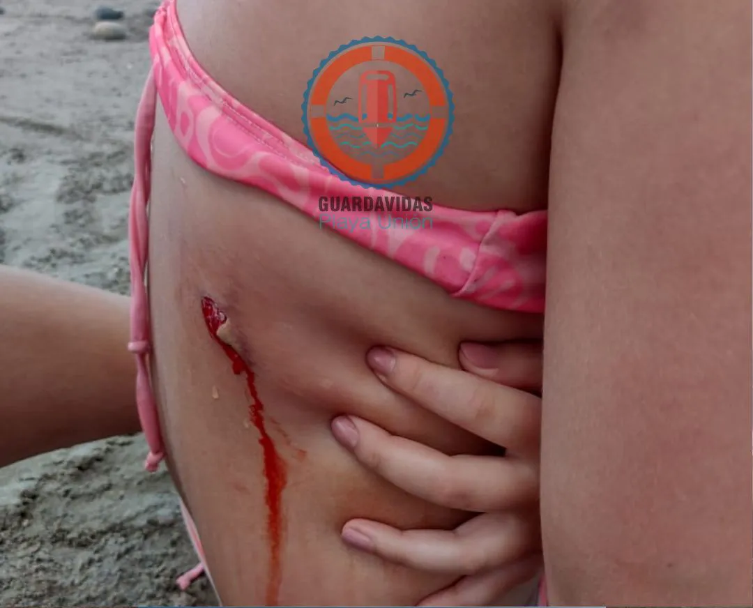 Una nena fue mordida por un lobo en Playa Union