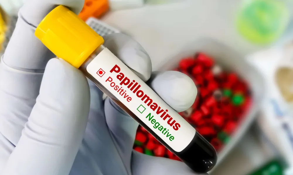 HPV