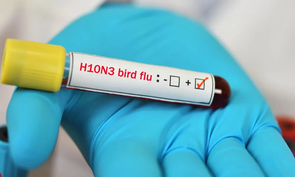 H3N2 imagen ilustrativa