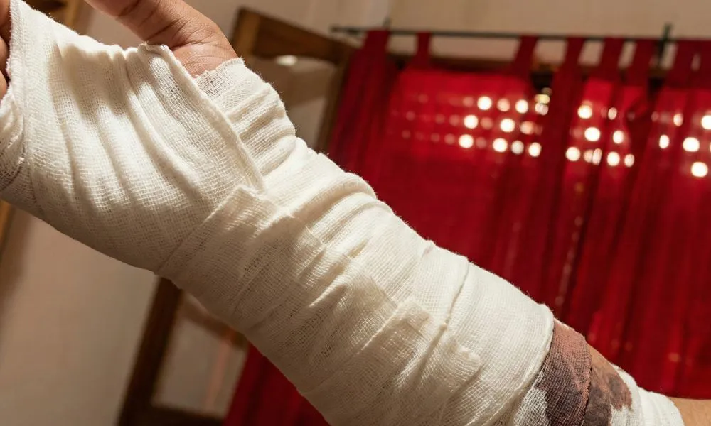 Brazo de cadete atacado imagen reeditada digitalmente por LA17