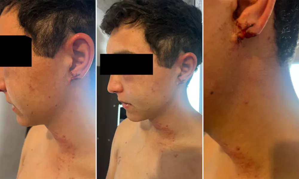 joven peón golpeado