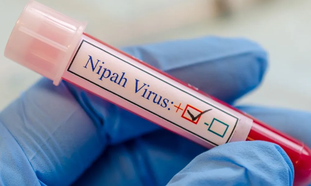 Virus Nipah. Foto semFYC