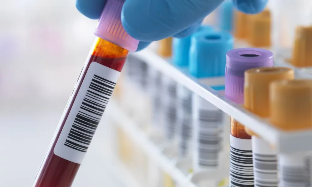 Nuevo estudio sobre el Alzheimer