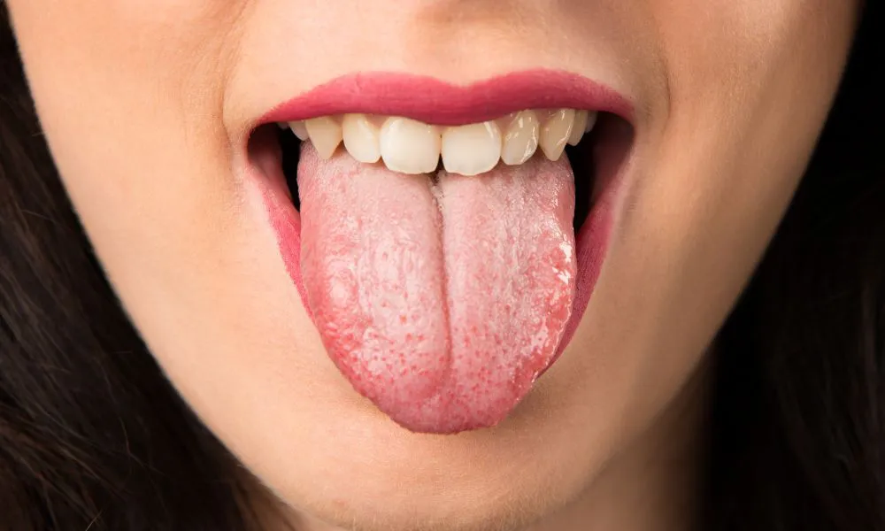 Aspecto de la lengua