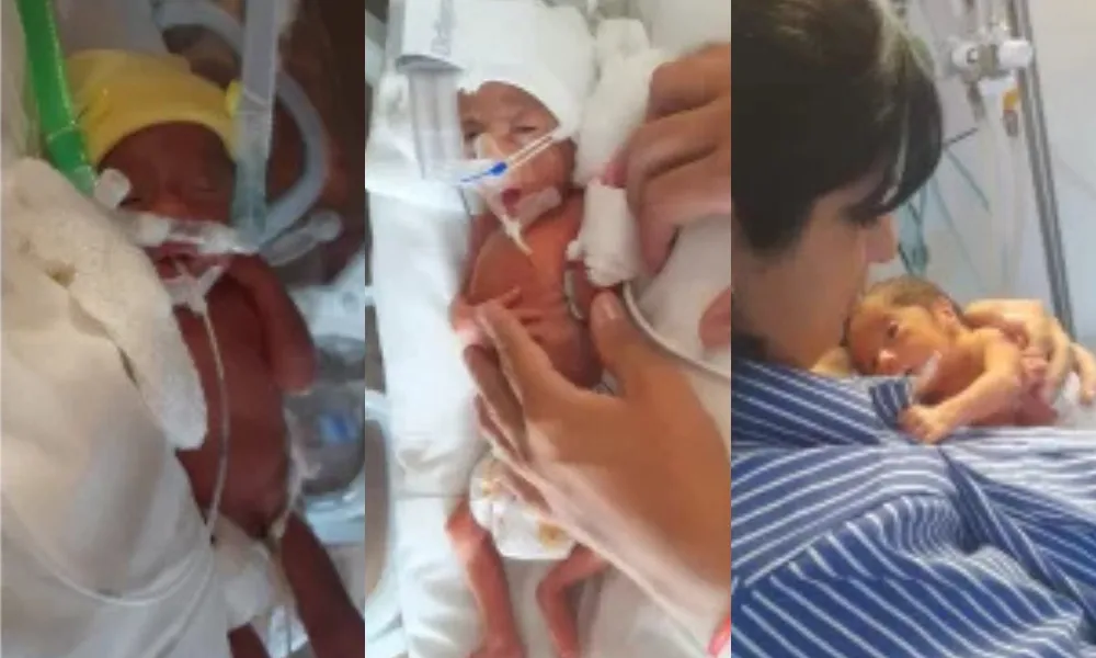 Trigemelas en Santa Cruz