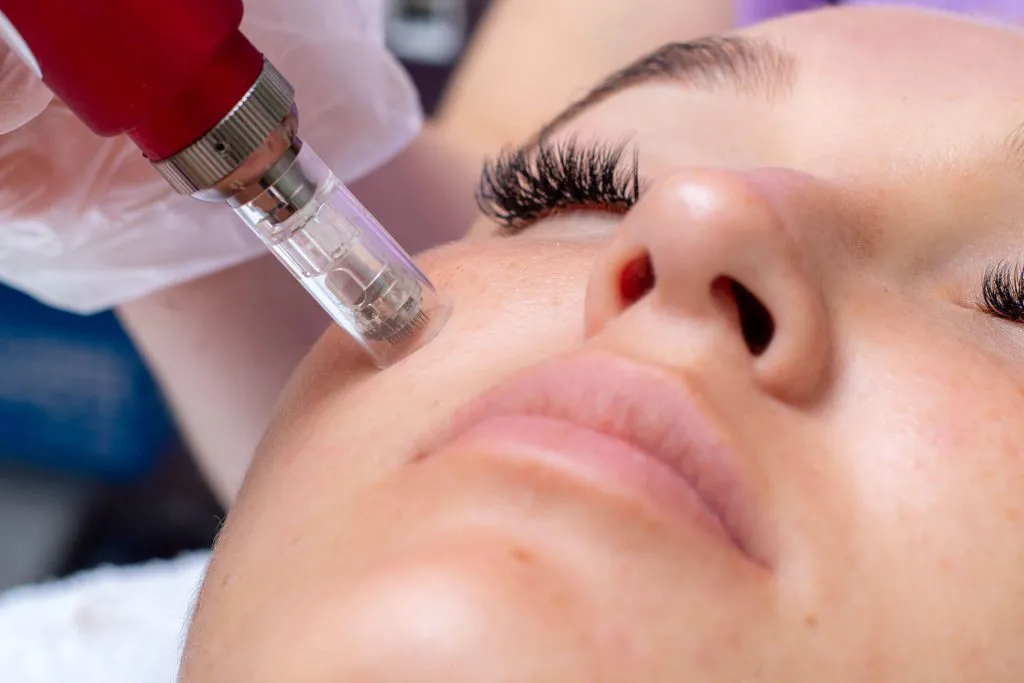 Microneedling