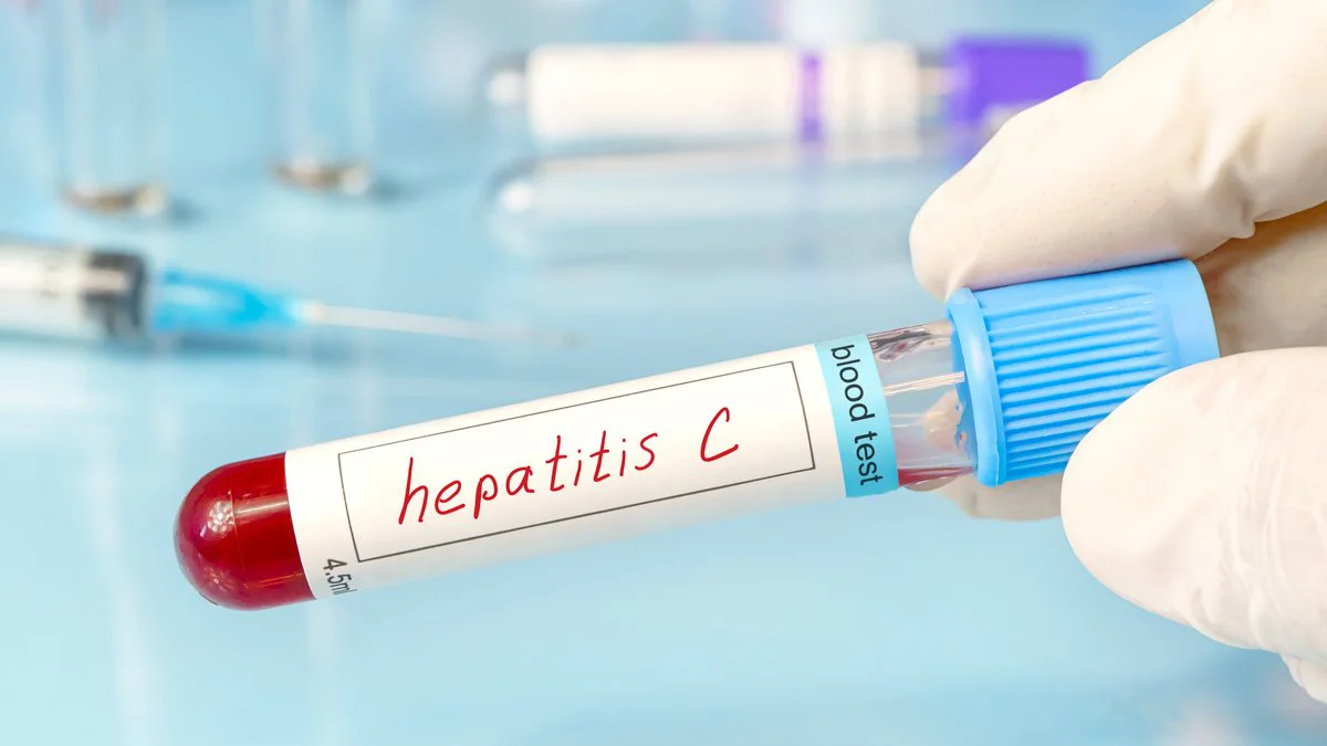 Hepatitis C. Foto Magnific