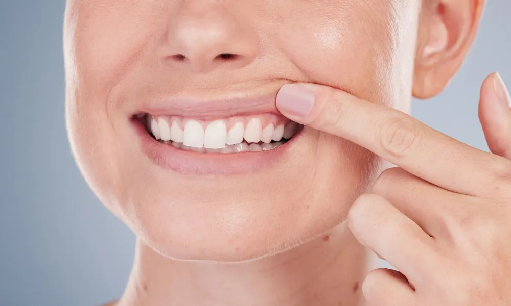 Gingivitis