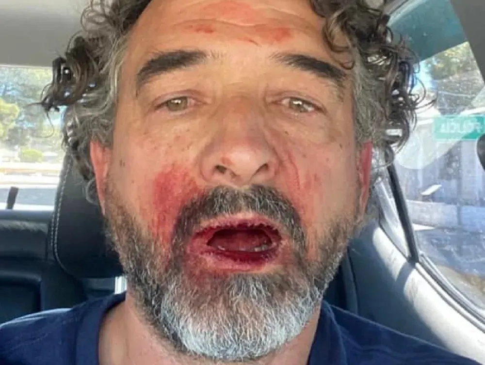 albaini agredido interior