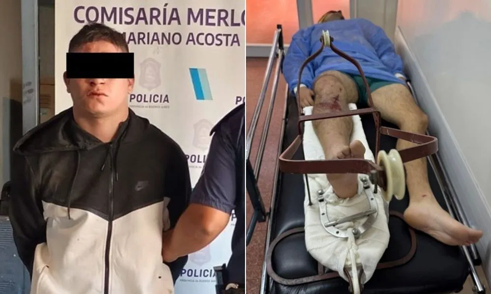 Motochorros atropellados