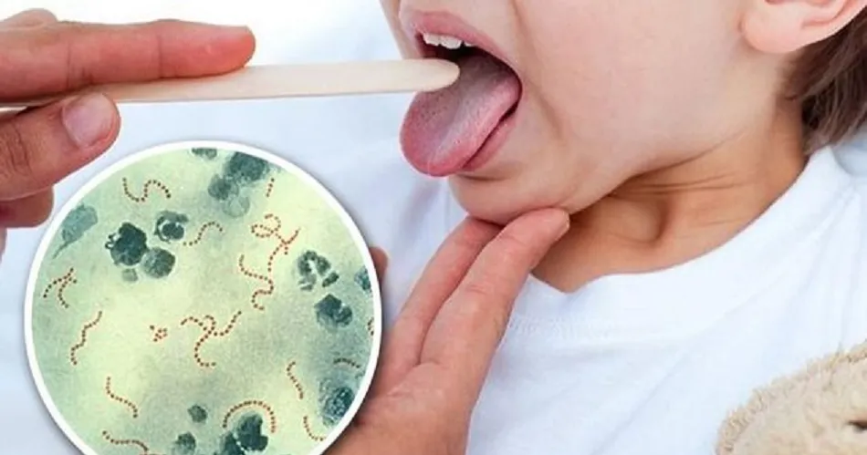 Streptococcus pyogenes