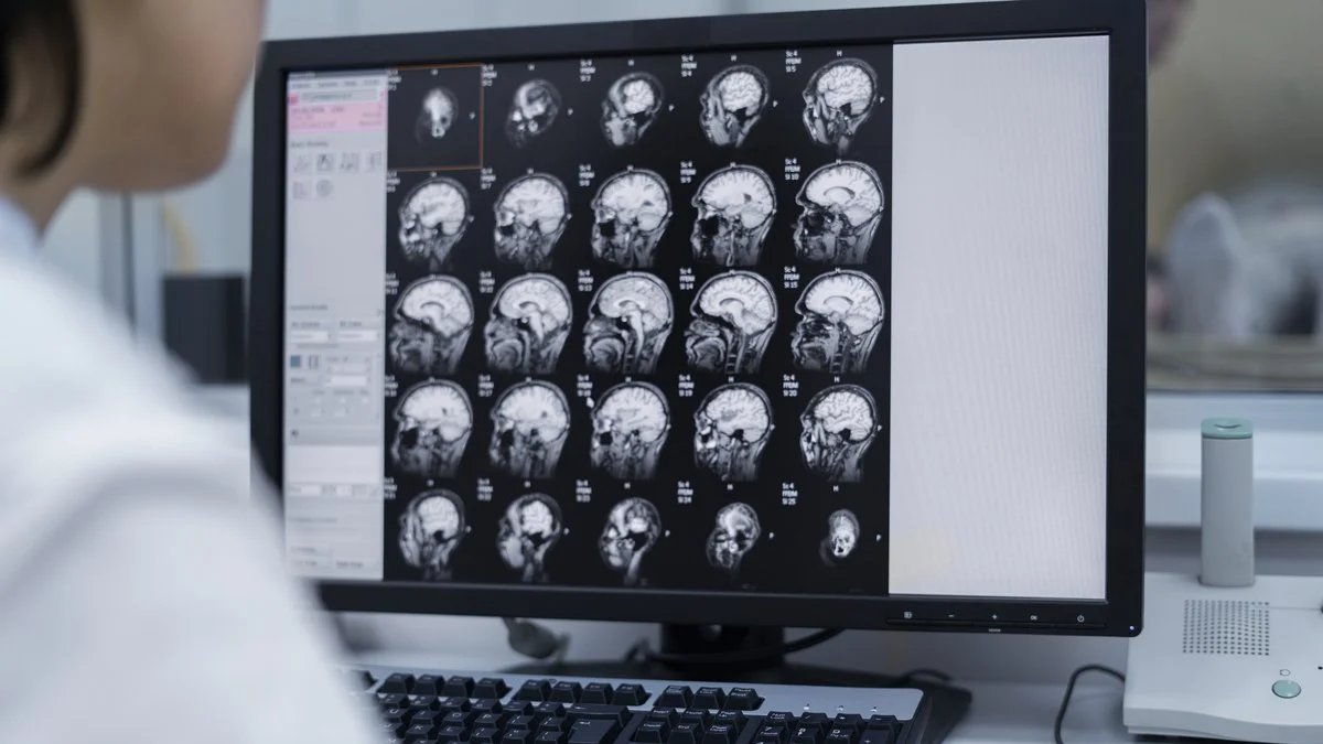 Tumor cerebral. Foto Magnific