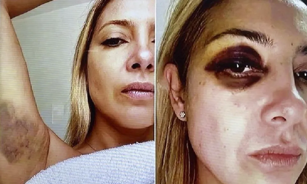 fabiola golpeada
