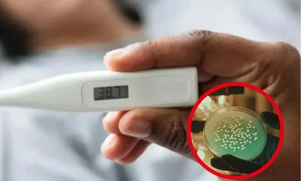 Brote de fiebre Tifoidea