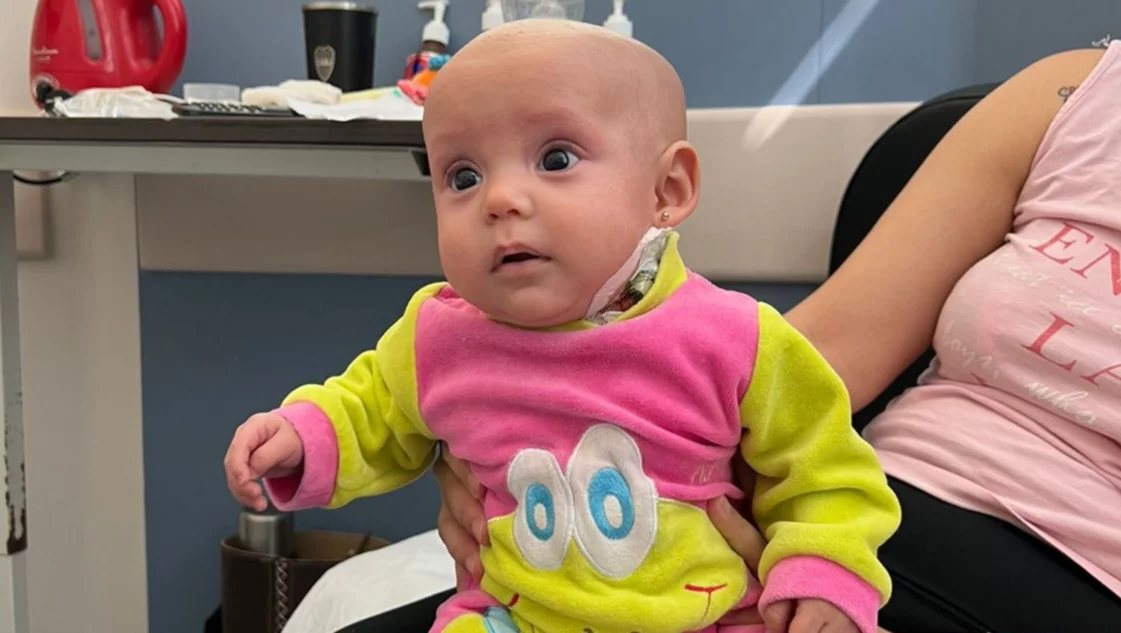 Ambar beba que necesita un trasplante de timo
