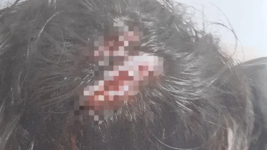 Menor golpeado por otro en al escuela-1