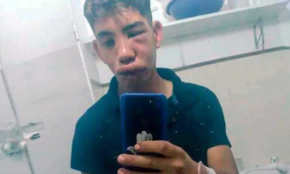 Jóven agredido